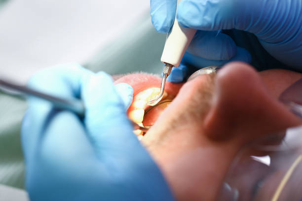 Best Emergency Care for Gum Disease in Drain, OR