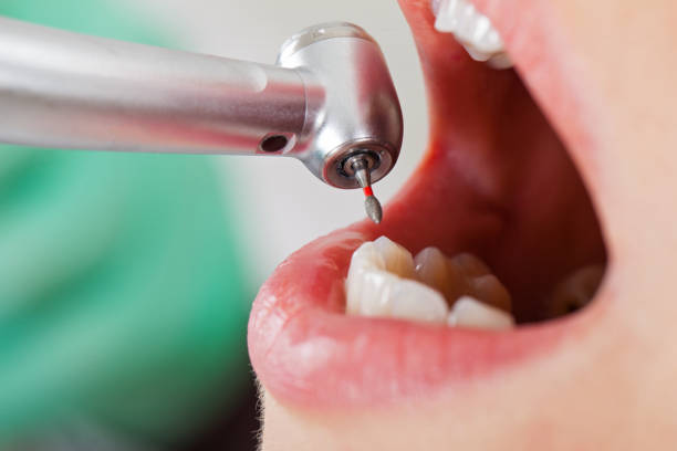  Drain, OR Emergency Dentist Pros